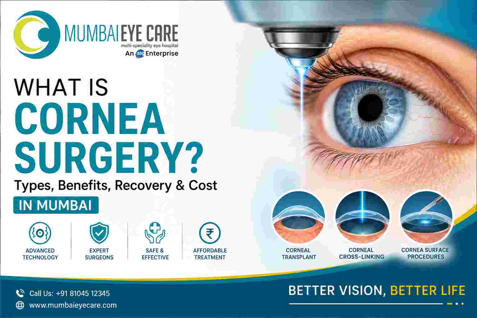 What Is Cornea Surgery? Types, Benefits, Recovery & Cost in Mumbai